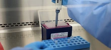 La universidad del Valle se une a la lucha contra el Coronavirus