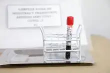 Avanza estudio de Ivermectina en pacientes con covid-19