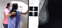 Alcaldía de Cali ratificó su compromiso para la detección temprana de cáncer de mama 