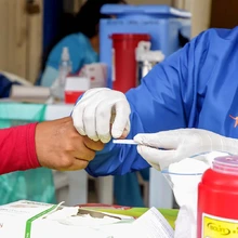  La hepatitis no puede esperar: conoce cómo prevenirla