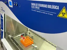 Red de Salud Centro puso en marcha primer laboratorio para el diagnóstico temprano de tuberculosis