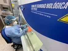 Red de Salud Centro puso en marcha primer laboratorio para el diagnóstico temprano de tuberculosis