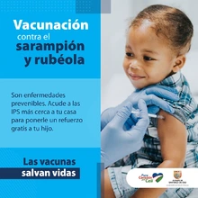 En Cali se buscan 236.720 niños para refuerzo de sarampión-rubéola