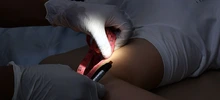 Red de Salud brinda servicios de planificación familiar para evitar embarazos e infecciones de transmisión sexual