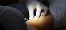 Red de Salud brinda servicios de planificación familiar para evitar embarazos e infecciones de transmisión sexual