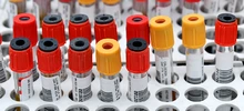 Moderno y renovado quedó el laboratorio clínico de la ESE Oriente 