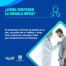 Cali completa dos semanas sin casos de viruela símica