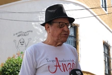 Una bala le dañó la cabeza hace 50 años. Y a pesar de eso, vive feliz